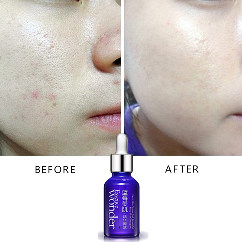 BIOAQUA Blueberry Face Lifting - Silk Press Serum incelemesi ve fiyatı