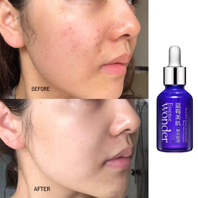 BIOAQUA Blueberry Face Lifting - Silk Press Serum incelemesi ve fiyatı