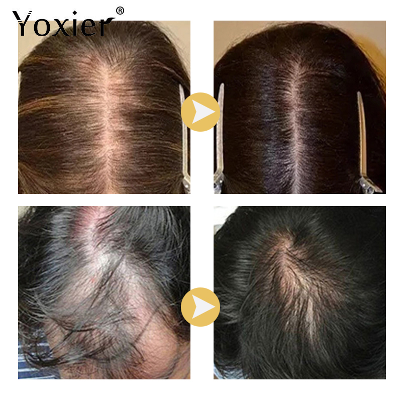 Intensive Growth Serum Prevent - Hair Care Serum incelemesi ve fiyatı