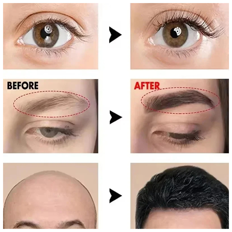 Fast Eyebrow Growth Serum Eyel - Hair Care Serum incelemesi ve fiyatı